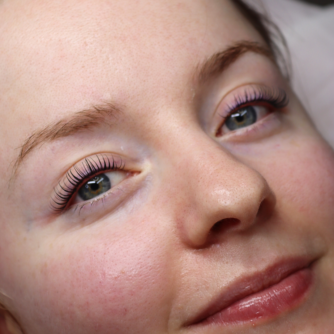 Rounded Glueless Shields