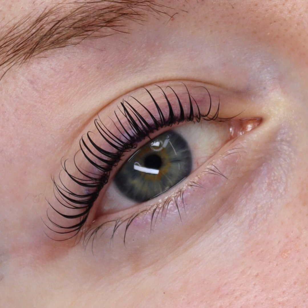 Rounded Glueless Shields