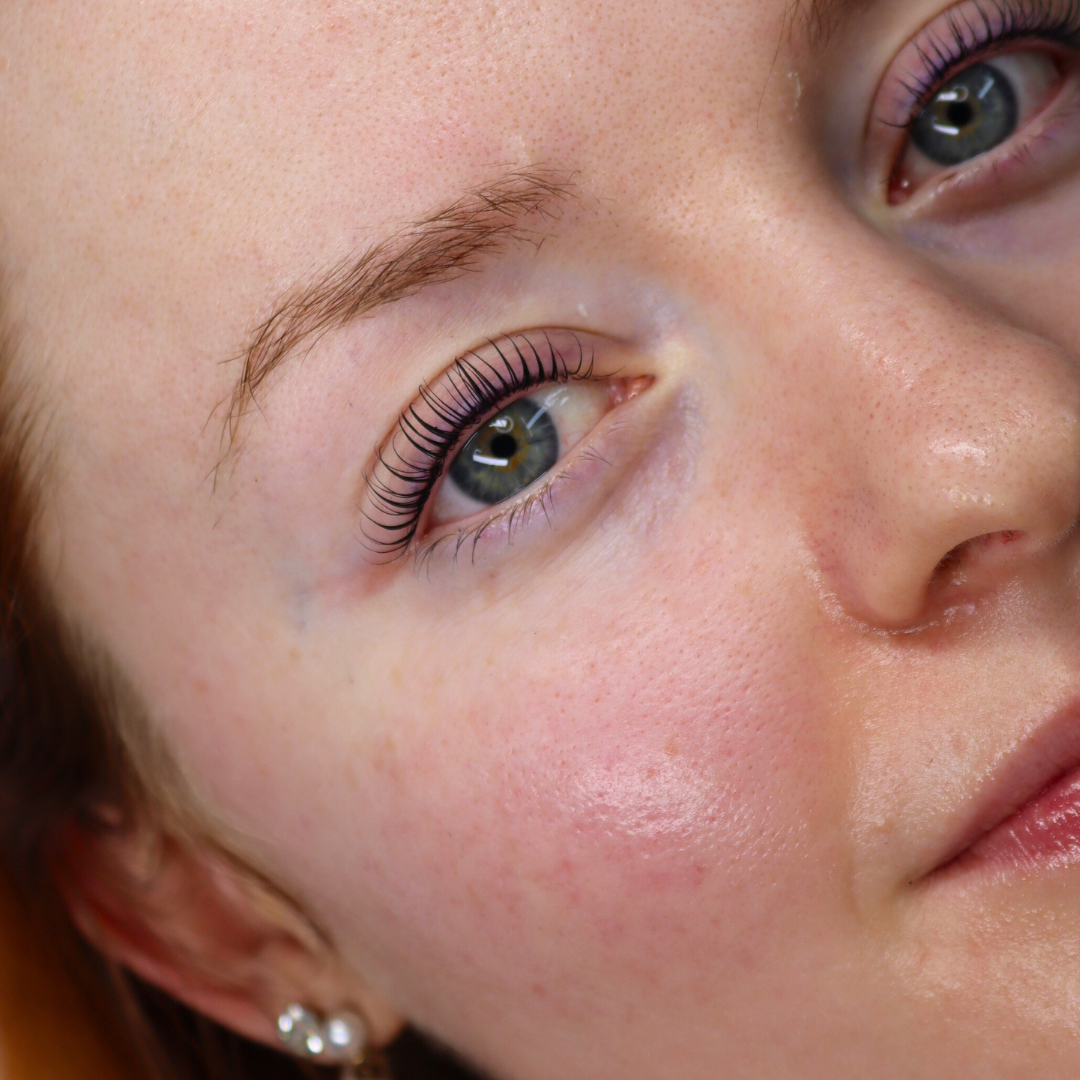 Rounded Glueless Shields