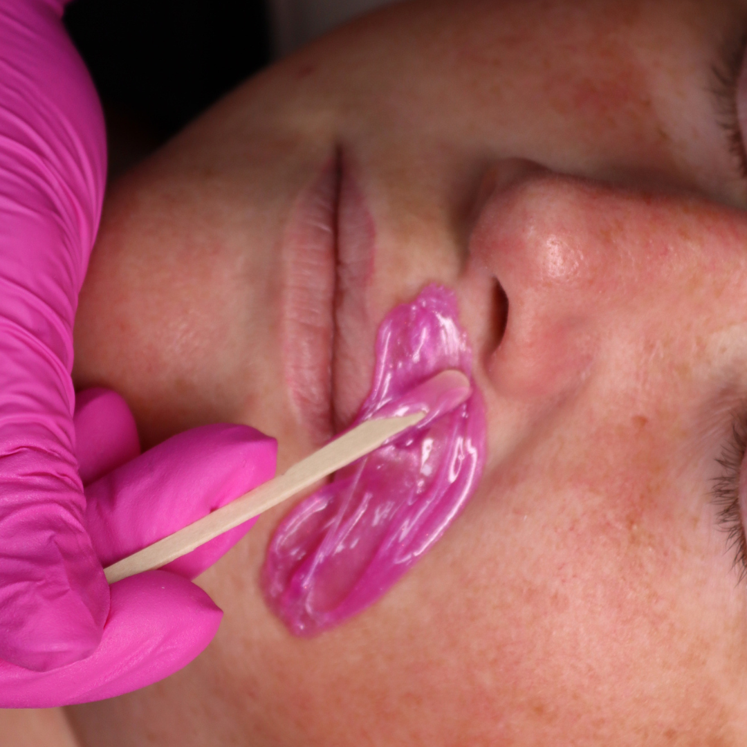 Hard Wax being applied with a facial waxing spatula to the upper lip.