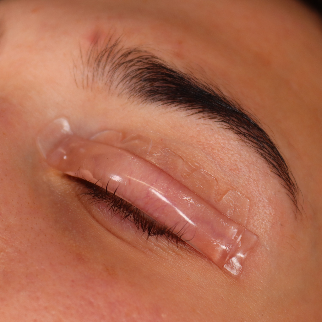 Hybrid Glueless Shields