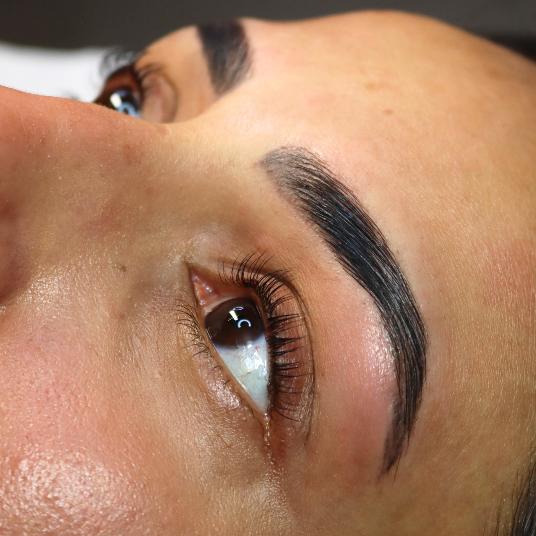 Cysteamine 3 Pump Bottles