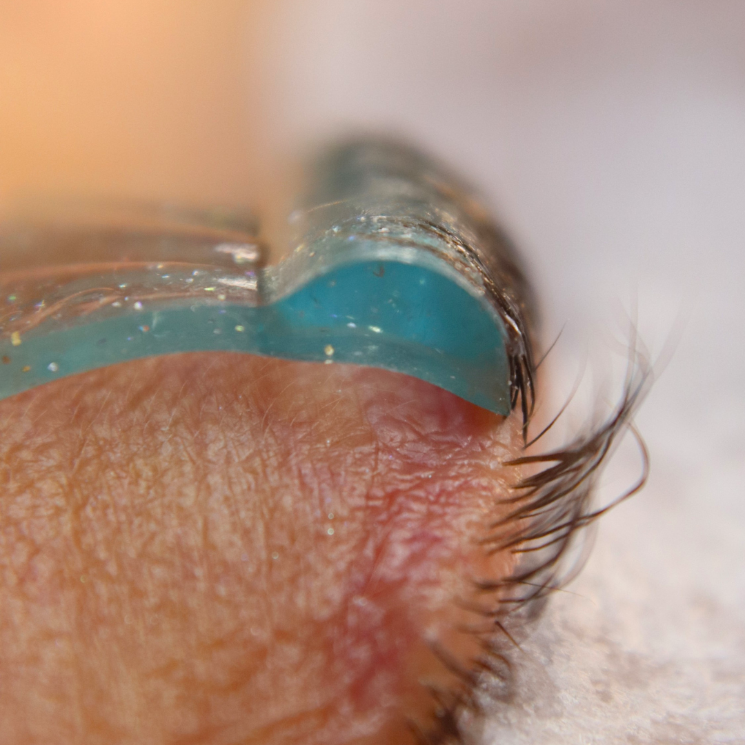 Rounded Glueless Shields