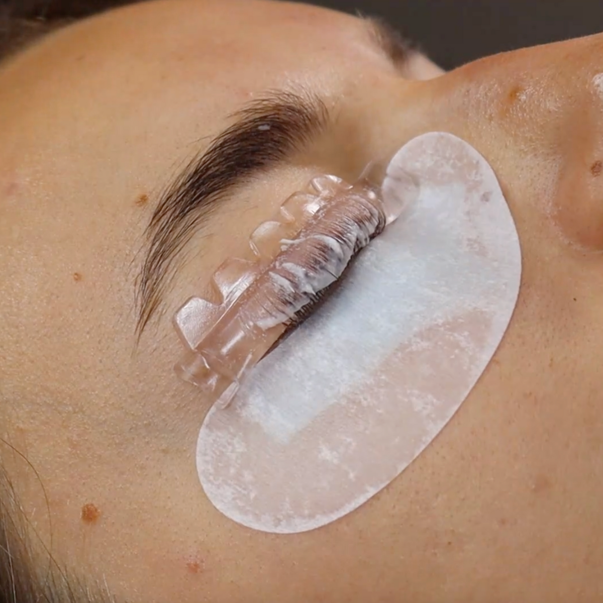 Hybrid Glueless Shields