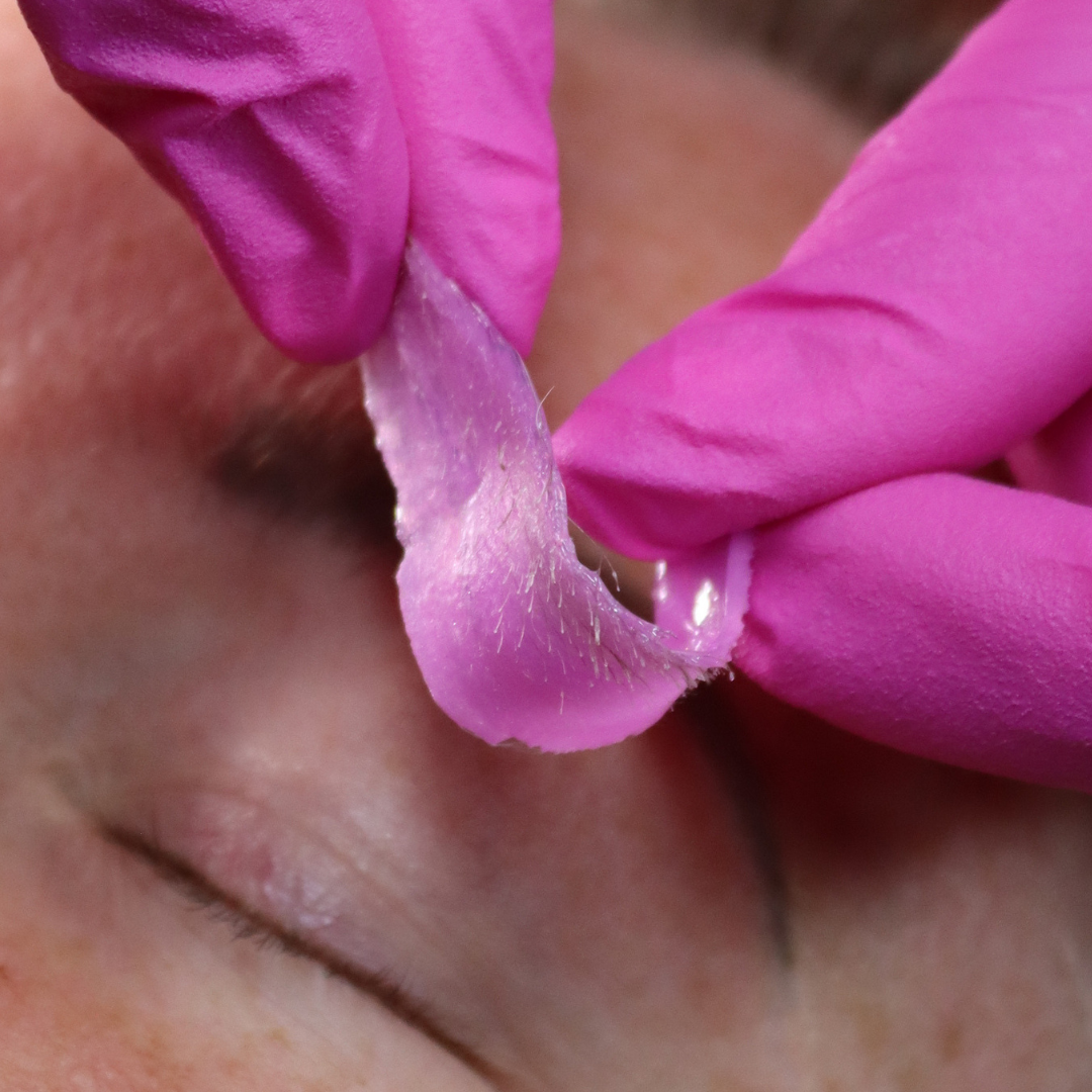 After shot of hair removal on the eyebrow using Pinkfishes Siren Hard Wax.