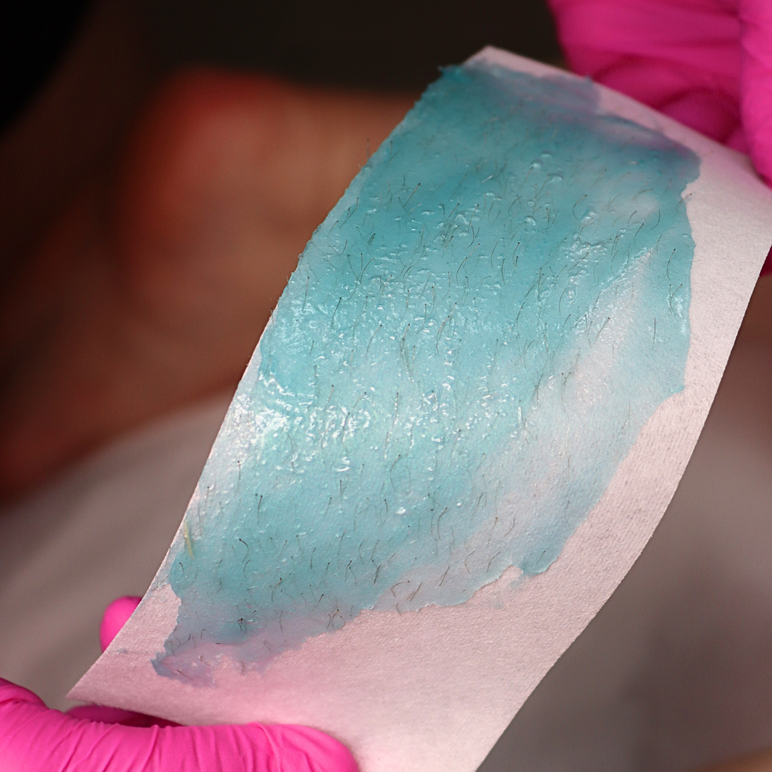 After results of hair revmoval on wax strip after using lagoon strip wax. 